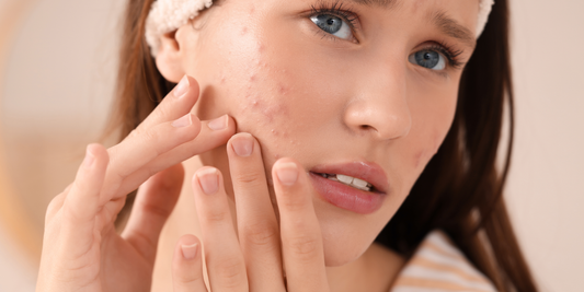Hormonal Acne Natural Treatment: Neem Oil & Ayurvedic Skincare