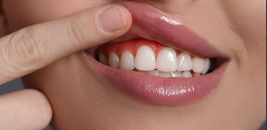  Oral Hygiene